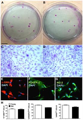 3D hydrogel environment rejuvenates aged pericytes for skeletal muscle tissue engineering